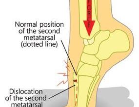 Buffalo Bills vs Cleveland Browns Week 16 Injury Review