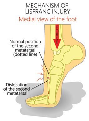 Buffalo Bills vs Cleveland Browns Week 16 Injury Review