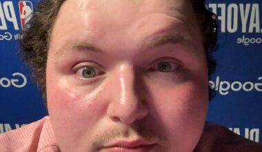 Rylan Stiles - Nikola Topic is warming up for the OKC Blue tonight. He will play in their game.