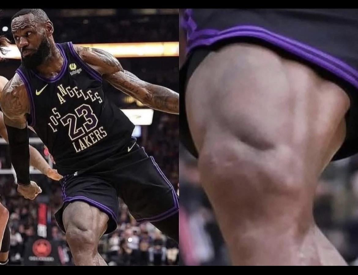 The Quadfather, Quadzilla, King James