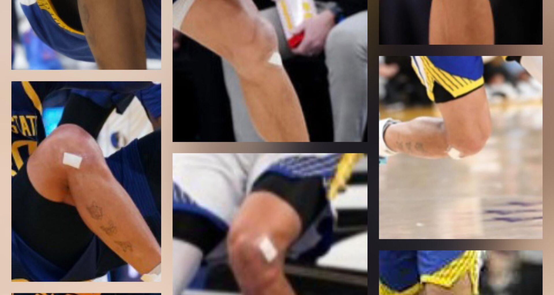 I think curry has been quietly dealing with Patellofemoral syndrome (or something else) for more than half his career. It's so hard to find a single picture where he doesn't have an injection site bandage.