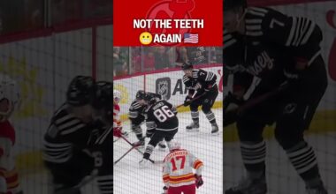 Olympic Teeth Flashbacks for Hughes 😬