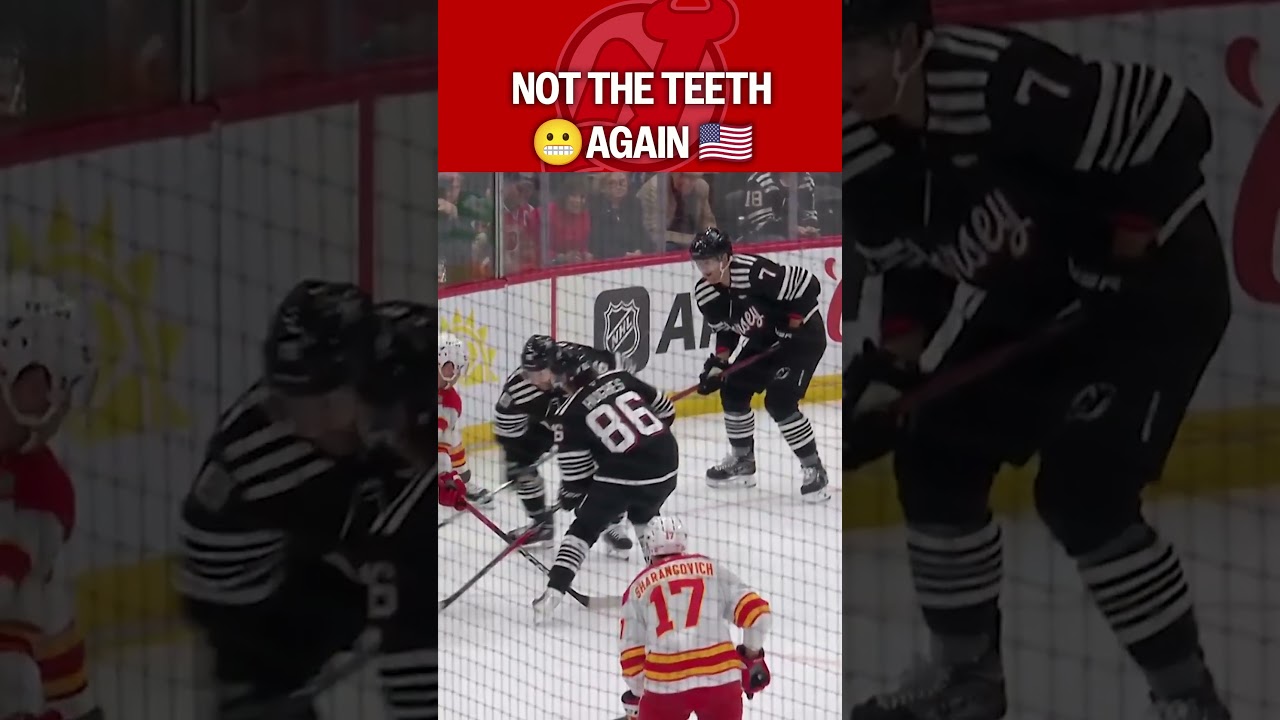 Olympic Teeth Flashbacks for Hughes 😬