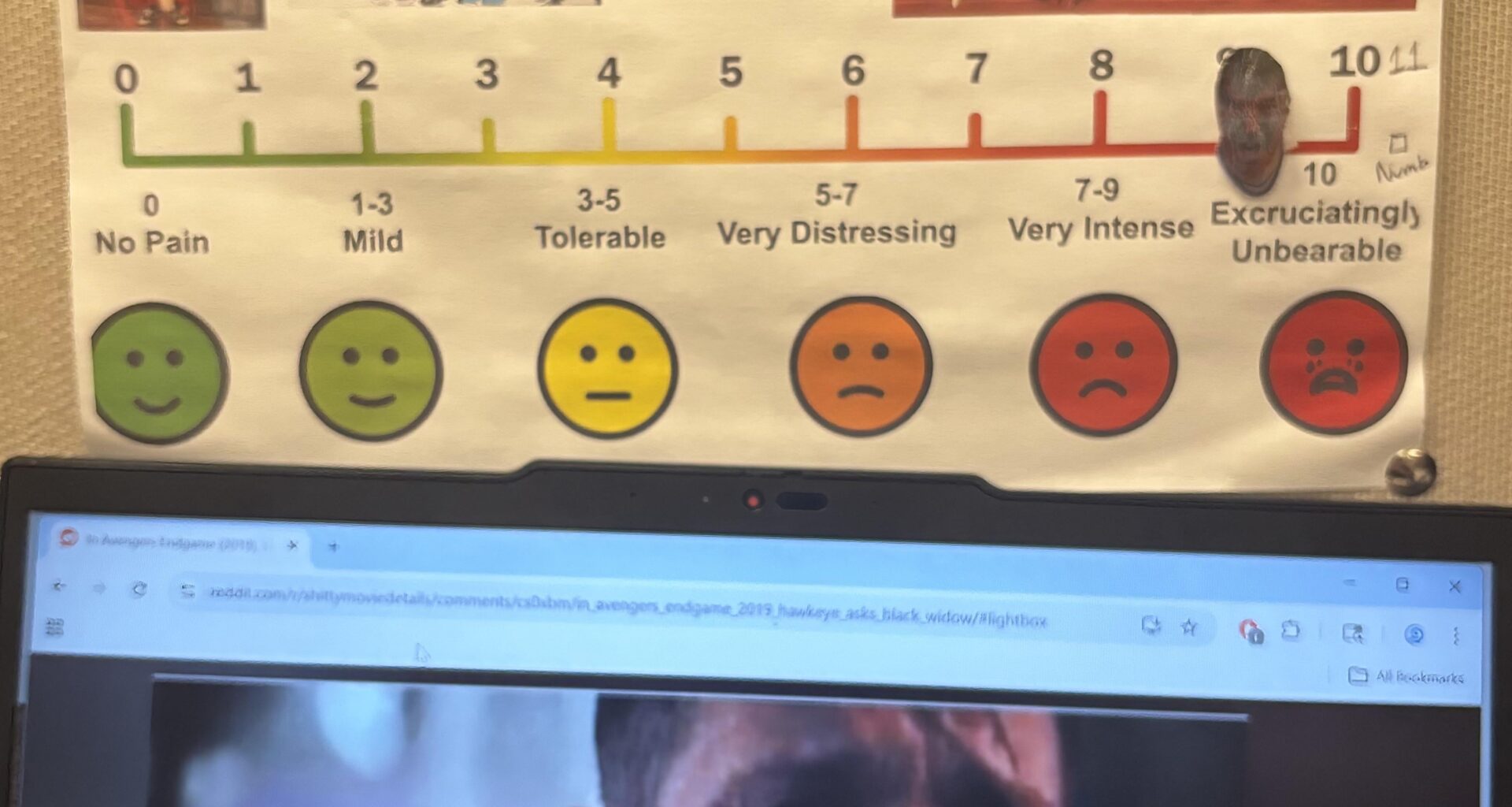 Weekly Update of the Devils Pain Meter