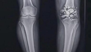 Live look at Jermod McCoy’s knee