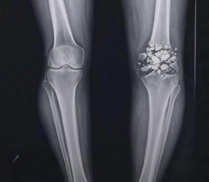 Live look at Jermod McCoy’s knee