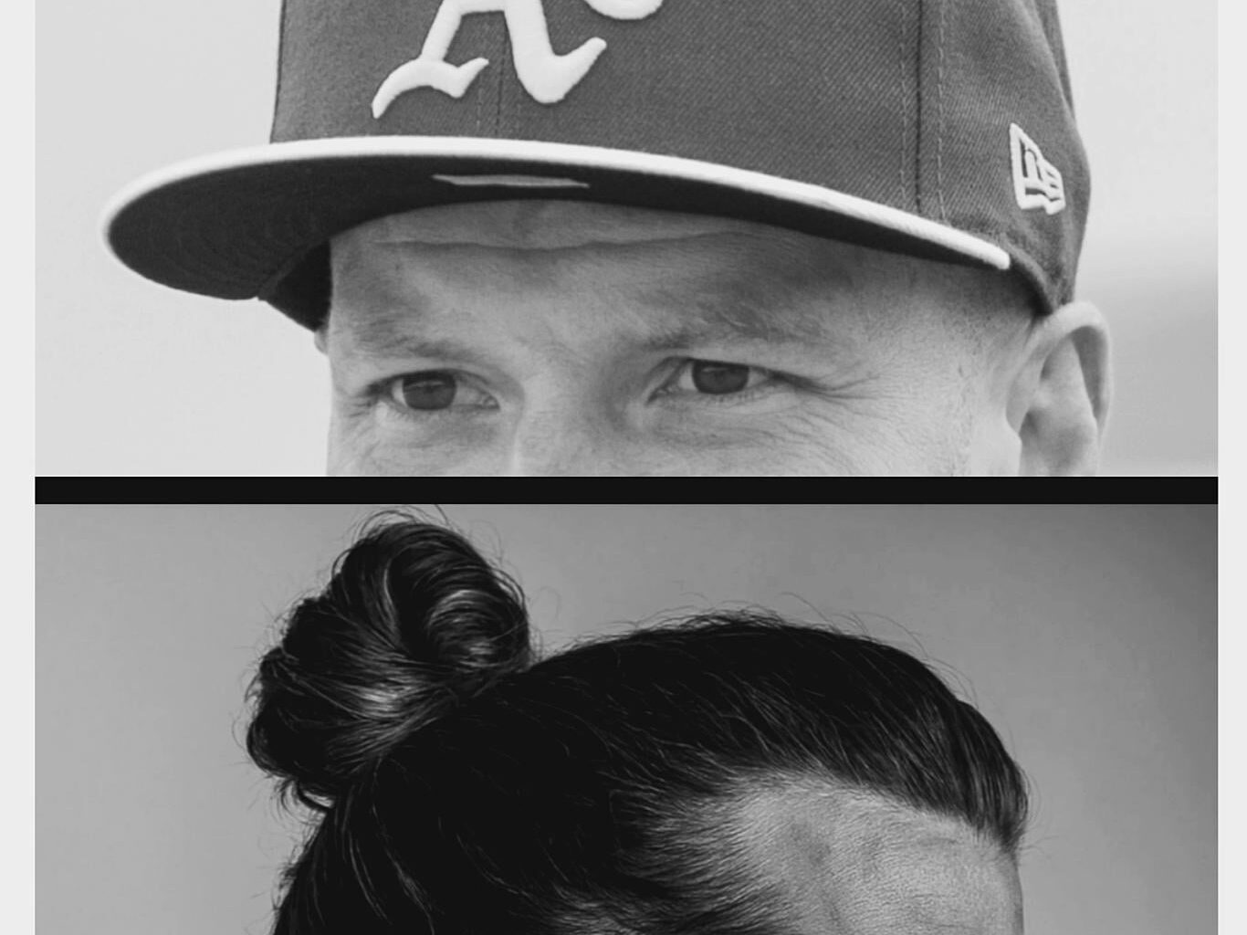 2 things worse than baldness