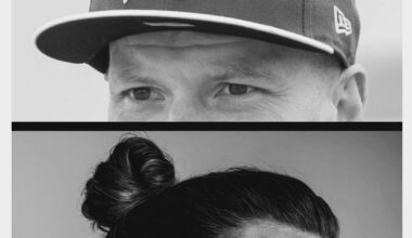 2 things worse than baldness