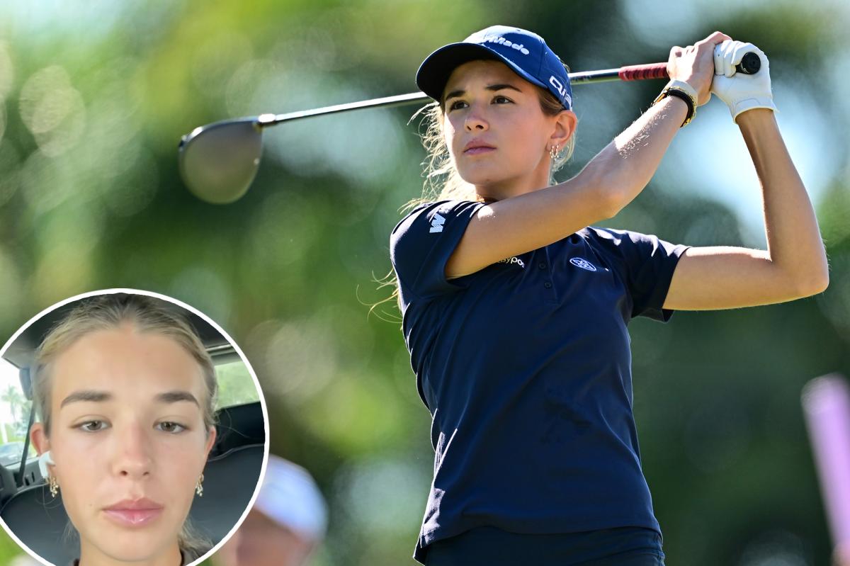 Kai Trump's college golf career at Miami starts with injury scare
